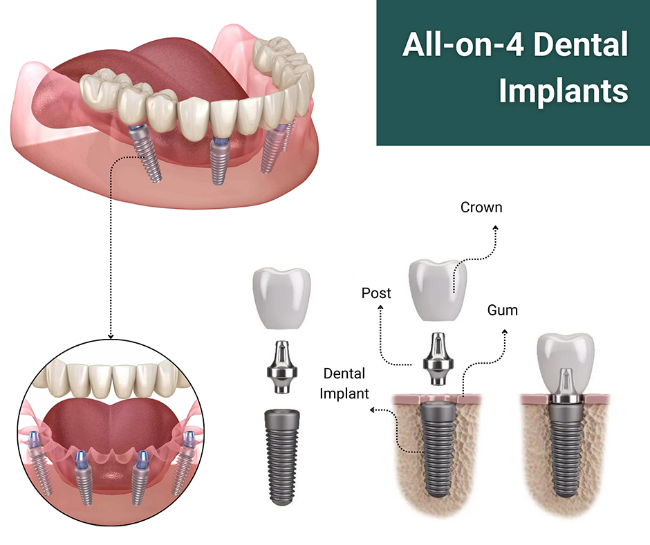 InStyle Dental Group - Emergency Dentist Houston TX - Dentist Houston - Cosmetic Dentist - Dental Implants