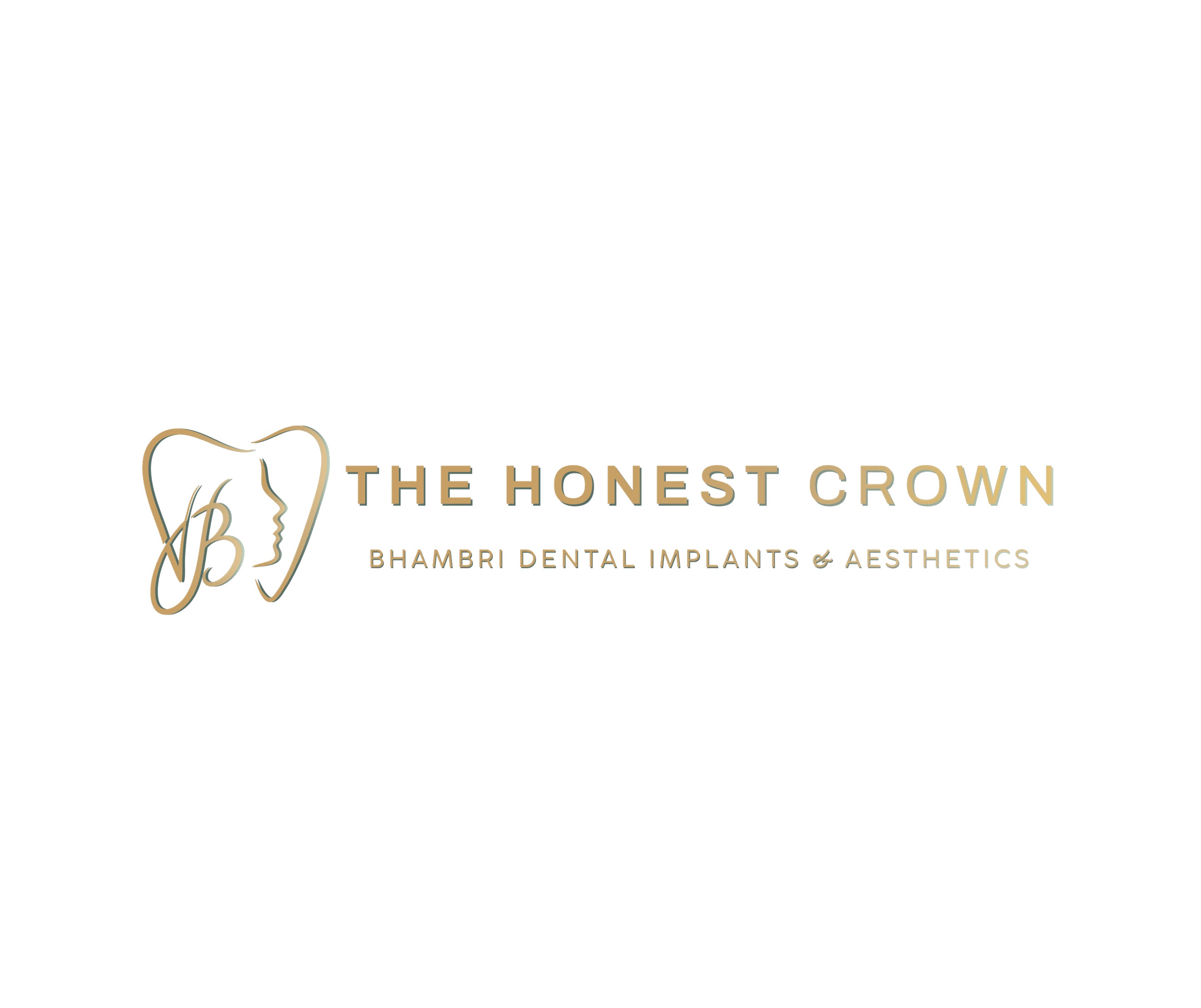 Dentist Livingston | The Honest Crown | Bhambri Dental Implants